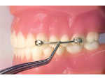 Ortodontický materiál, aparáty, kleště, nástroje, příslušenství v e-shopu